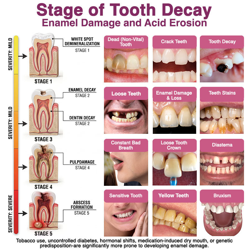 🇺🇸Trilumia® DenPerm🦷 Cavity-Repair Natural Enamel Filling Gel🌸
